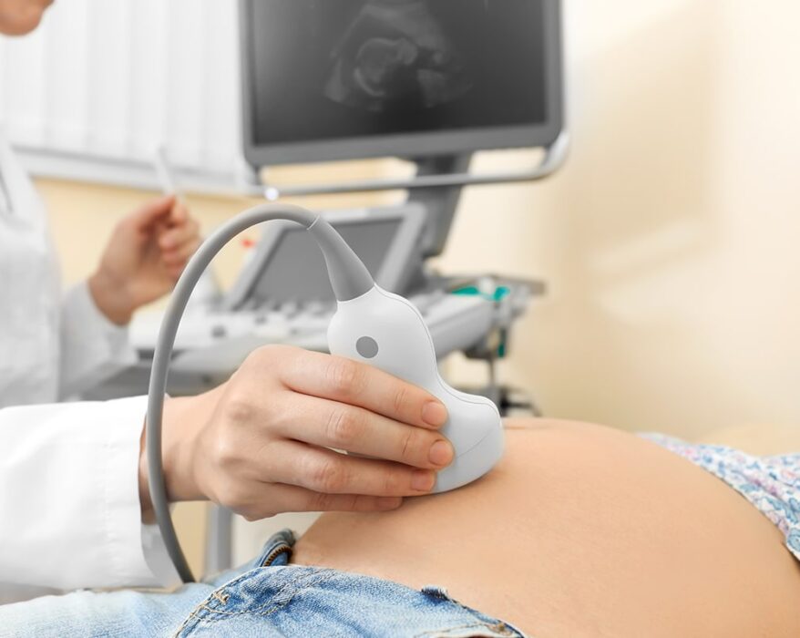Médico haciendo una ecografía a una mujer embarazada